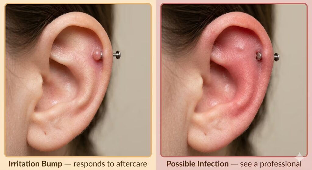 Piercing Infection vs. Irritation How to Tell the Difference